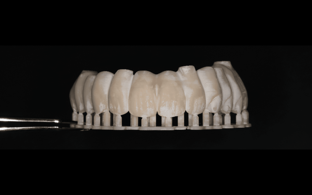 Implants & Digital Workflow:  Performer